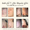 Savon Naturel Anti-Acné - Lait de Chèvre & Avoine