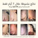 Savon Naturel Anti-Acné - Lait de Chèvre & Avoine